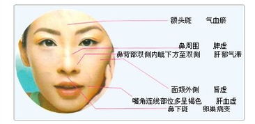 斑是怎么形成的，斑是怎么形成的?有几种原因?图片