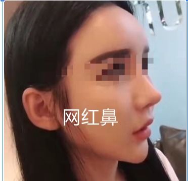 妈生鼻，妈生鼻型图片