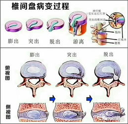 突出是什么意思,"突出"的汉语解释