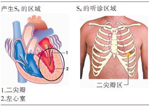 心音名词解释