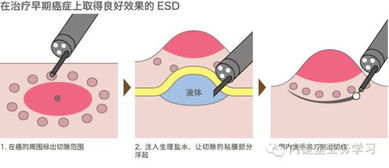 抬举的近义词抬举的近义词是什么